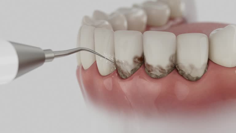 Reliable Root Canal Treatment contractor in Morgan County County, UT by Dentist Open Now